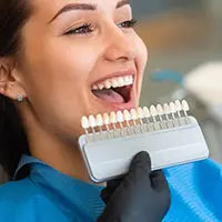 Tooth shade guide